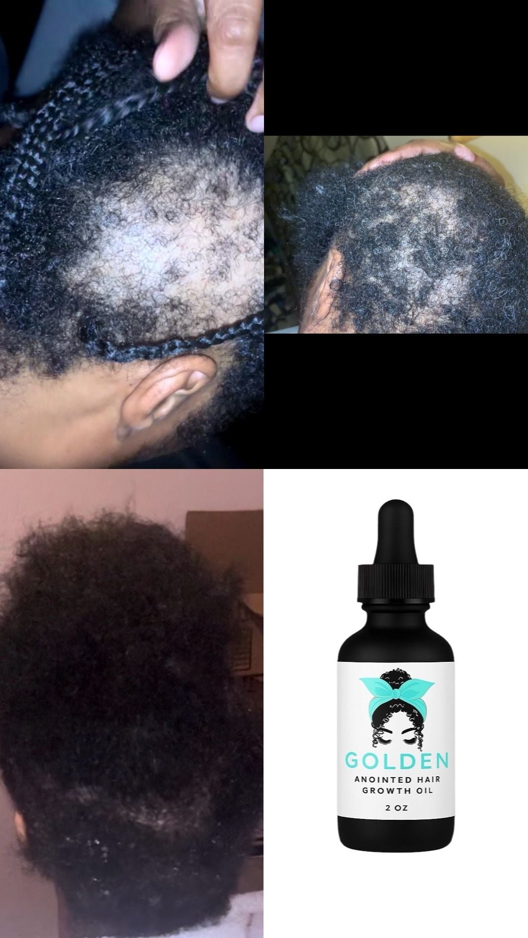 Golden Healthy Hair Care System